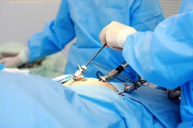 Методы лечения варикоцеле - уникальная лапароскопическая операция