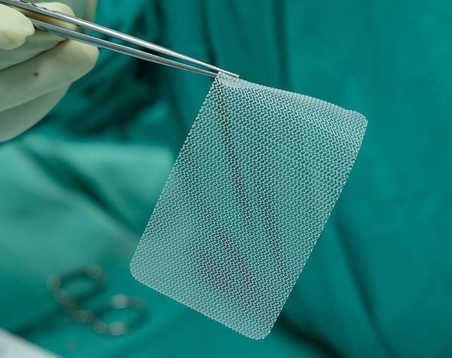 Хирургическое лечение послеоперационных грыж с применением сетчатых имплантов