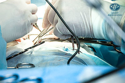 Хирургическое лечение послеоперационных грыж с применением сетчатых имплантов