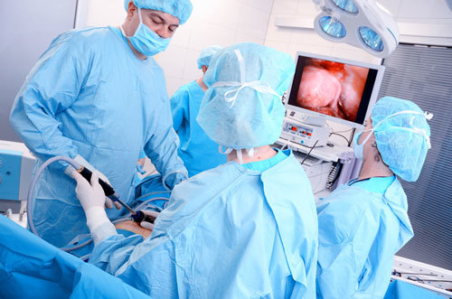 Органосохраняющая лапароскопическая операция при миоме матки